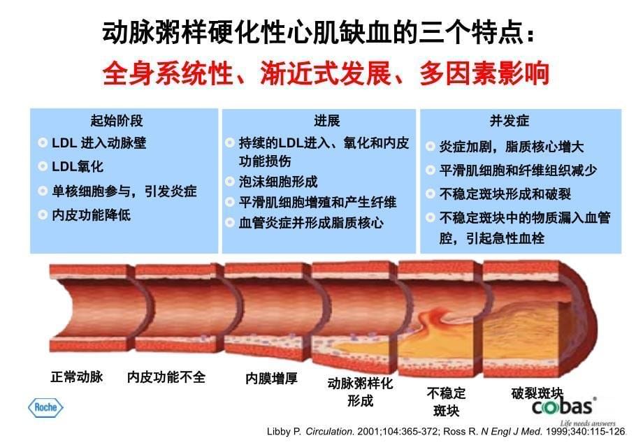 高敏肌钙蛋白T的临床应用中国医科大学附属盛京医院马淑梅_第5页