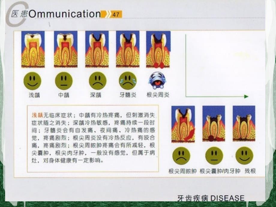 医学专题：口腔常识的误区及正确指导_第4页