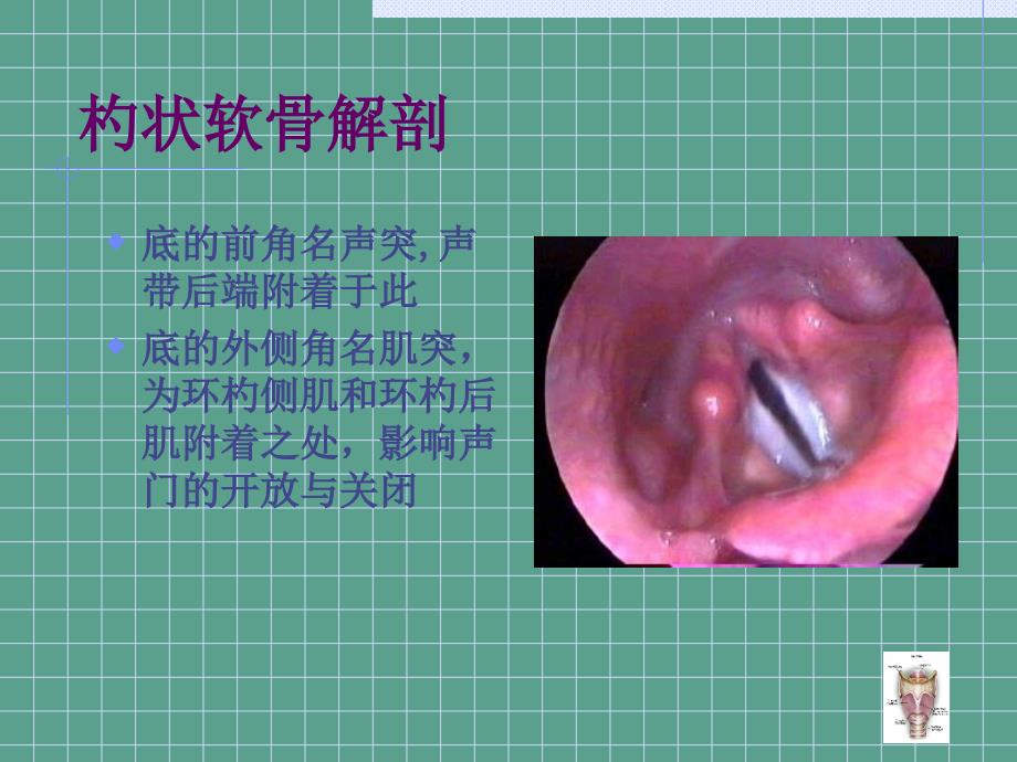 杓状软骨脱原因及处理ppt课件_第4页