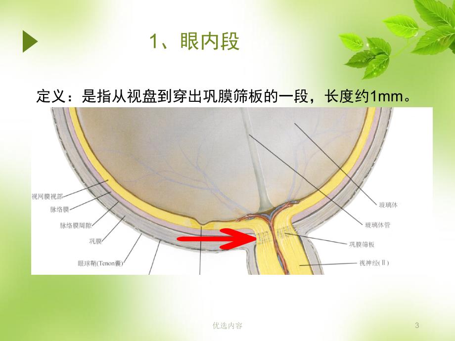 视神经萎缩伤残鉴定参考材料_第3页