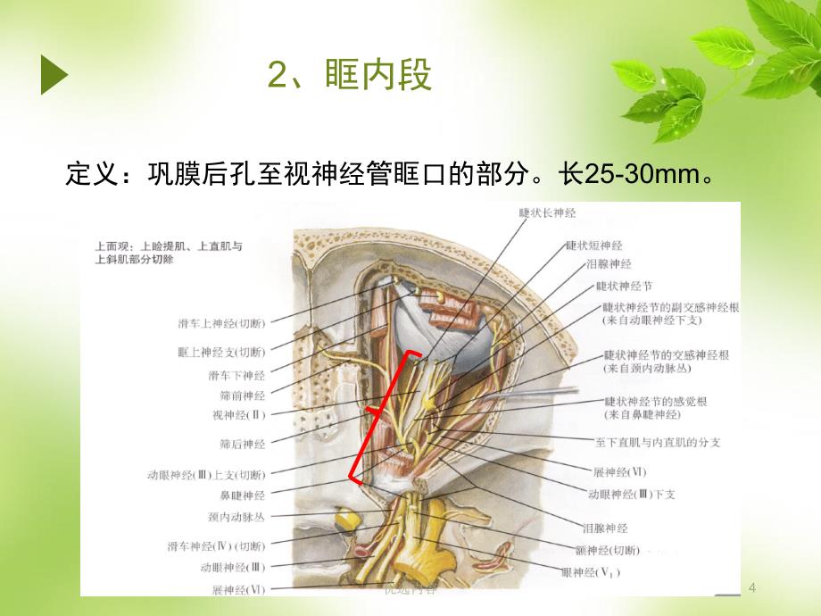 视神经萎缩伤残鉴定参考材料_第4页