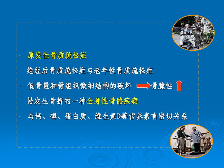 骨质疏松症与痛风的营养浙大_第4页