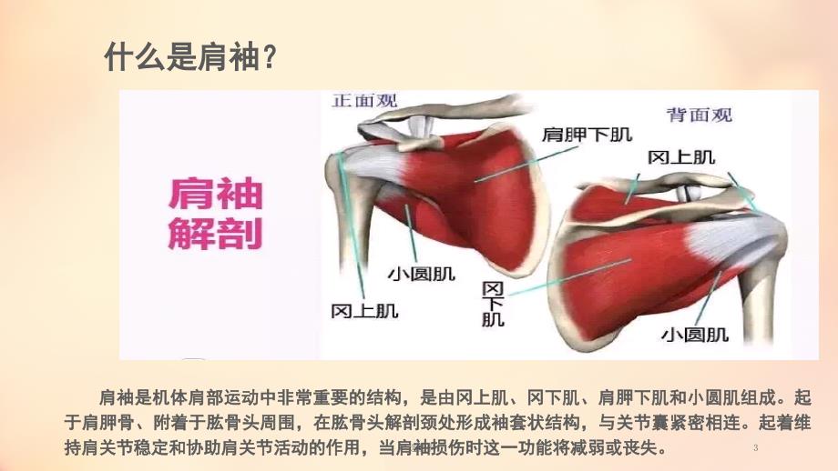 肩袖损伤护理疾病查房（行业荟萃）_第3页