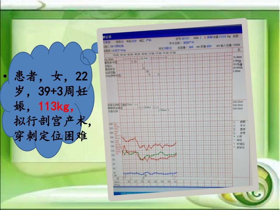 浅谈肥胖患者的麻醉处理_第1页