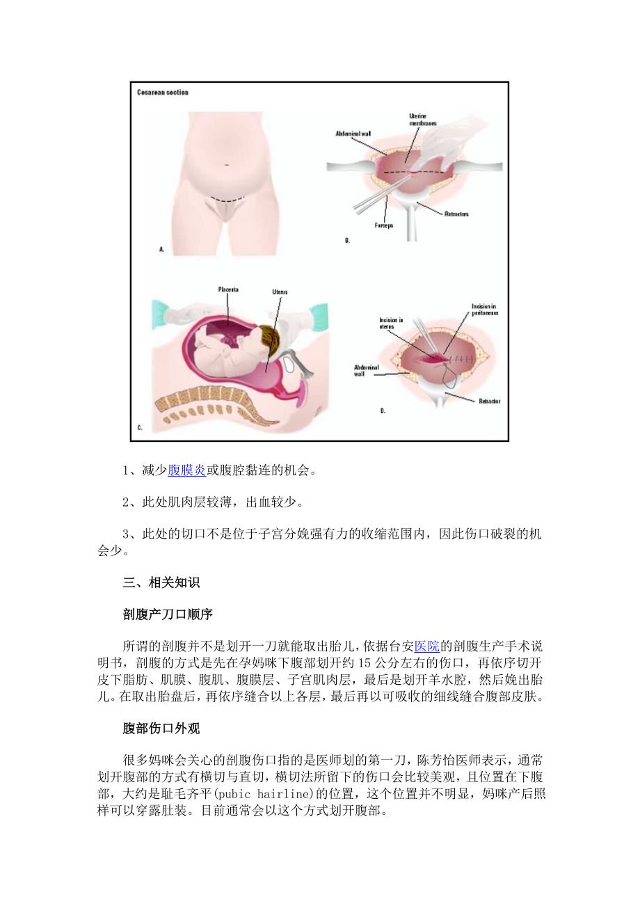 剖腹产横切和竖切的区别_第3页