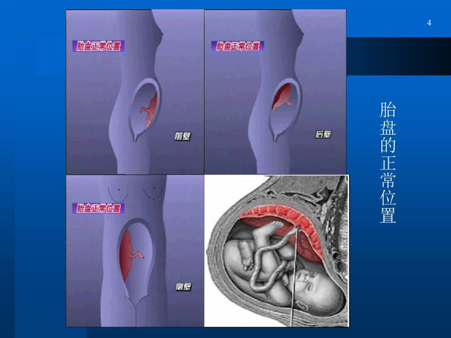 前置盘精课件.ppt_第4页