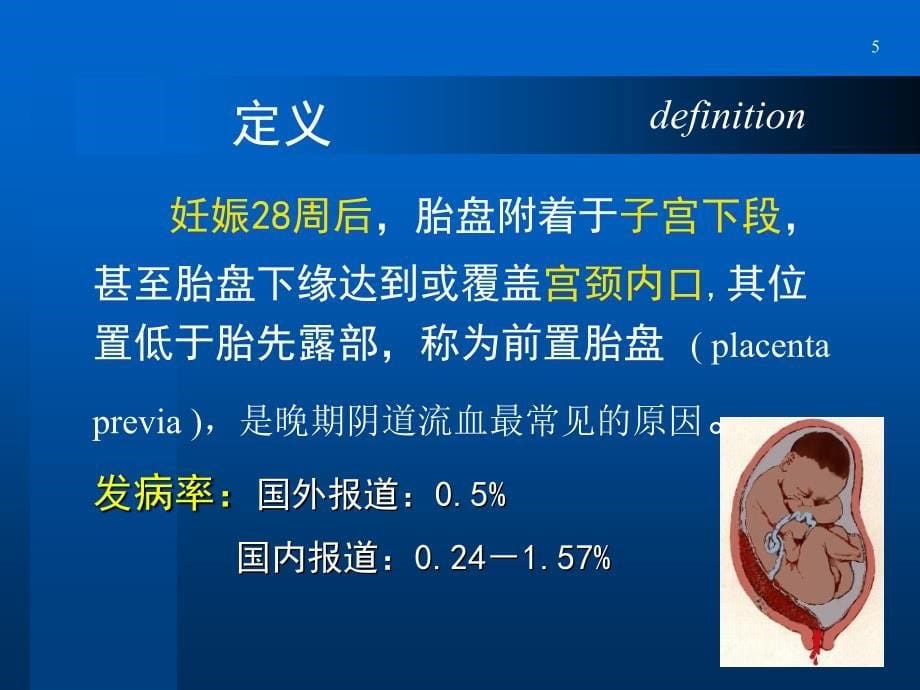 前置盘精课件.ppt_第5页