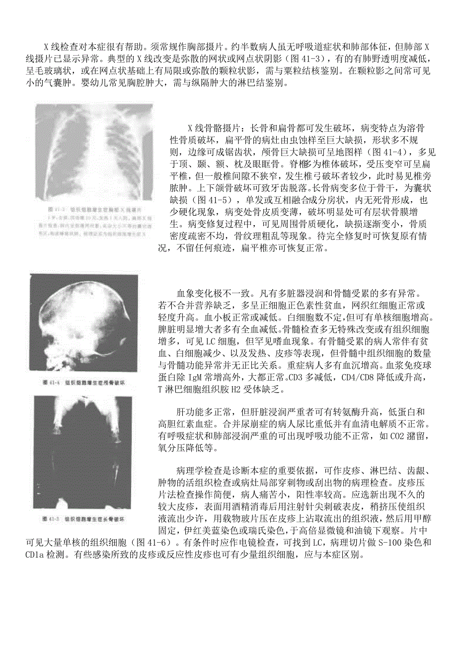 组织细胞增生症.doc_第4页