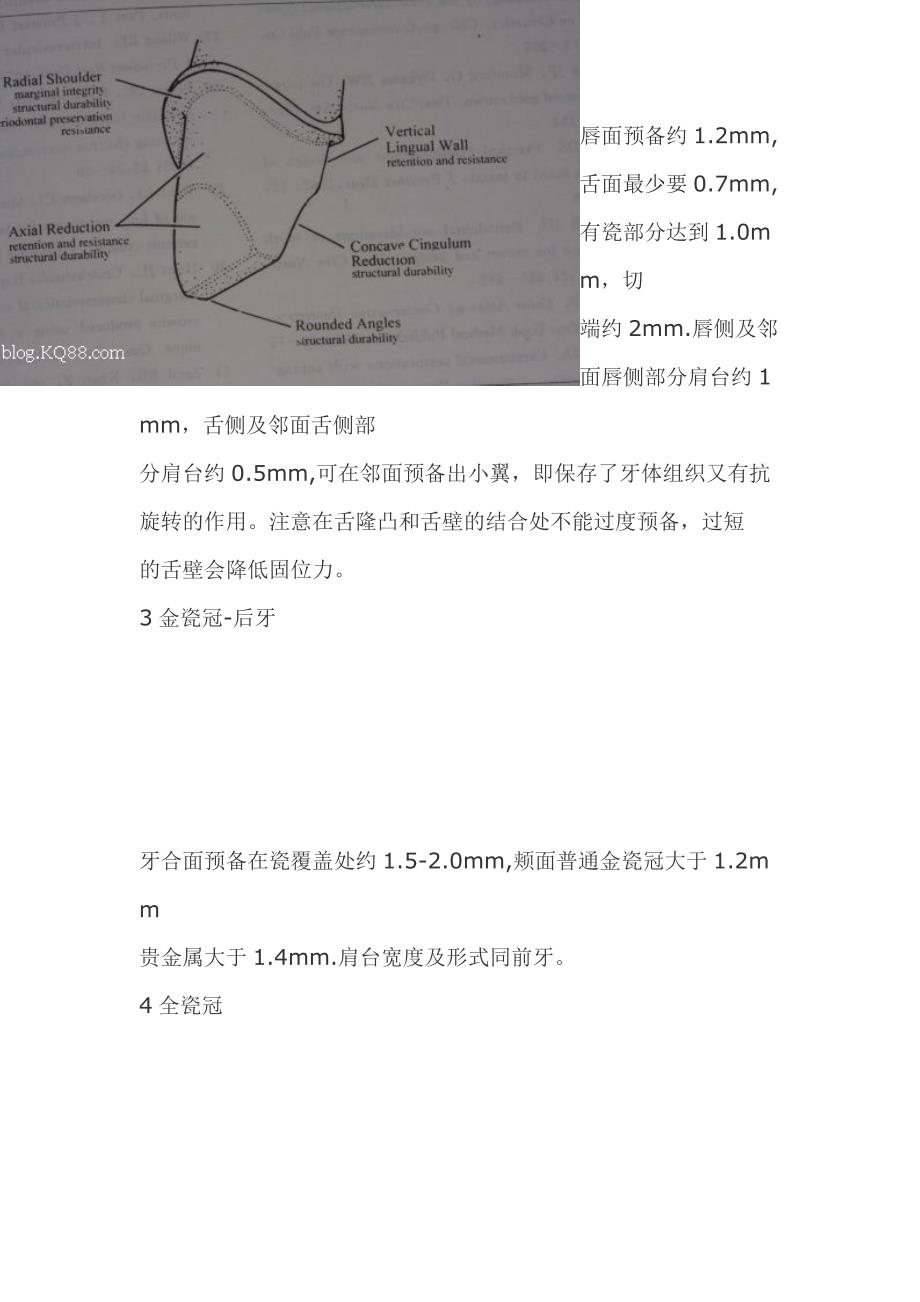 牙体预备原则及各种修复体的预备.doc_第3页