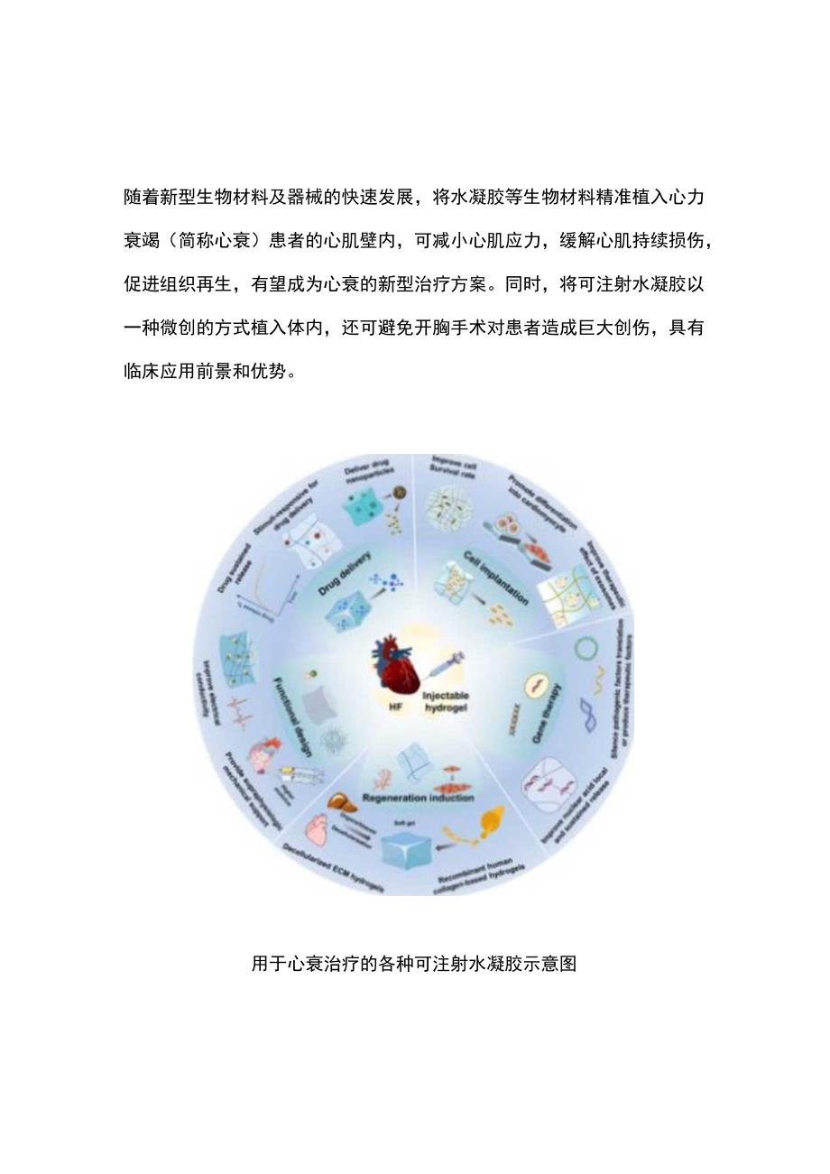 2023可注射水凝胶或成心衰治疗新方案（全文）_第1页