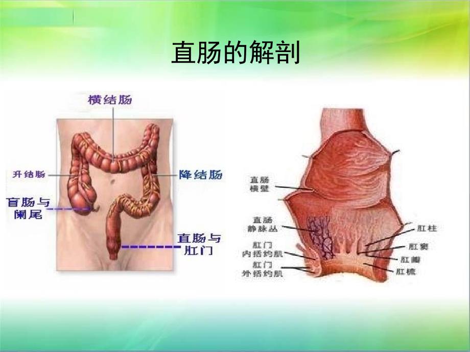 直肠癌病例讨论_第3页