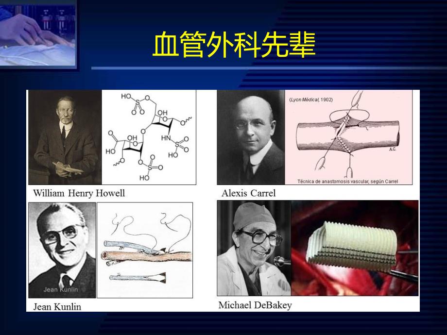 外科学课件：周围血管疾病及淋巴管疾病_第4页