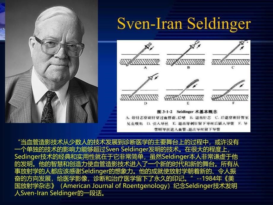 外科学课件：周围血管疾病及淋巴管疾病_第5页