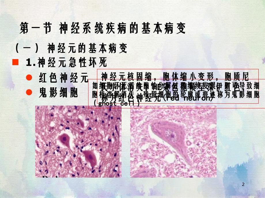 病理学第14章神经系统疾病第7版_第1页