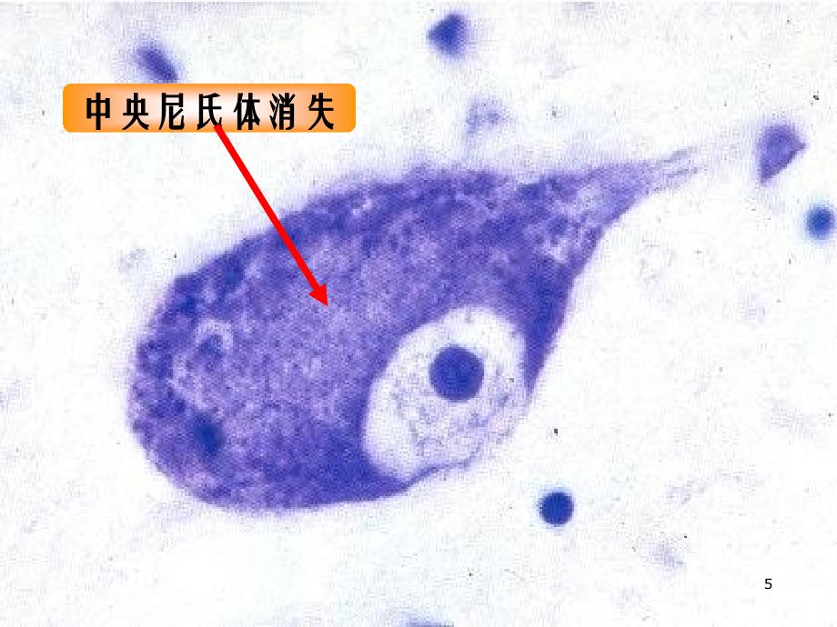 病理学第14章神经系统疾病第7版_第4页