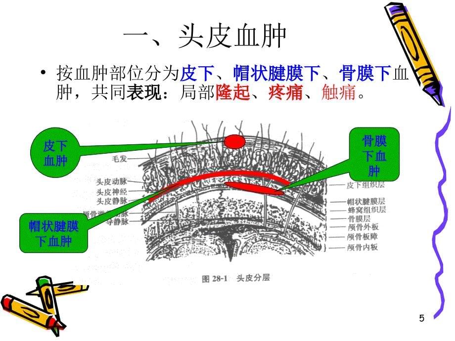 颅脑损伤病人的护理_第5页