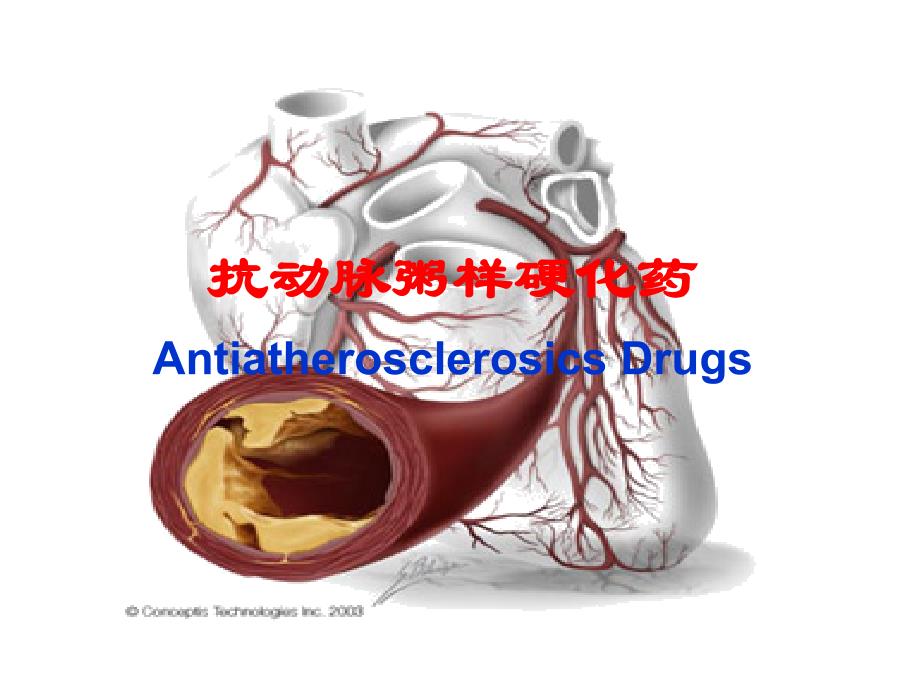 药理学教学课件：抗动脉粥样硬化药_第1页