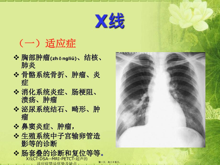 X线CTDSAMRIPETCT超声的适应症禁忌优势及缺点课件_第1页