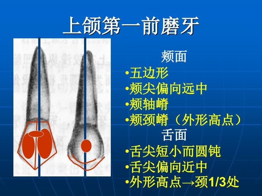 前磨牙牙体解剖 ppt课件_第5页