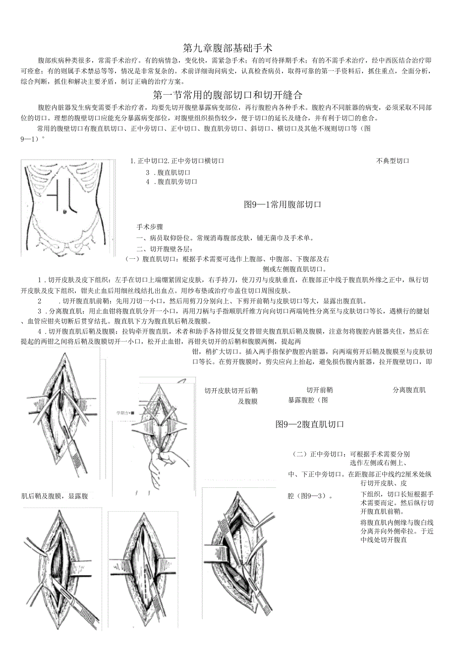 腹部基础手术_第1页