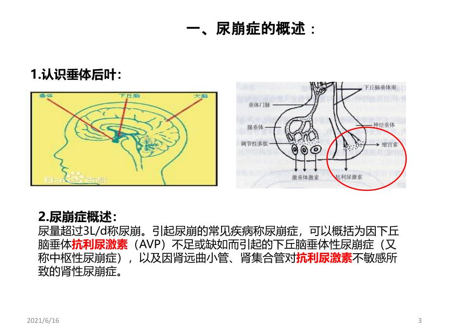 尿崩症护理查房_第3页