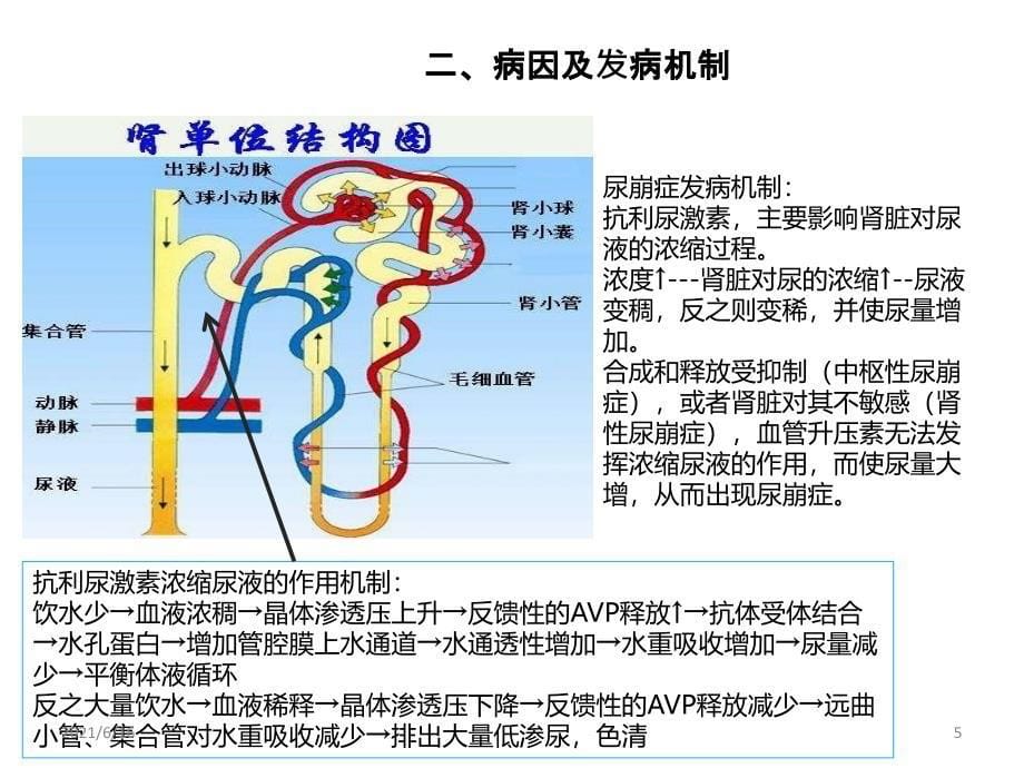 尿崩症护理查房_第5页