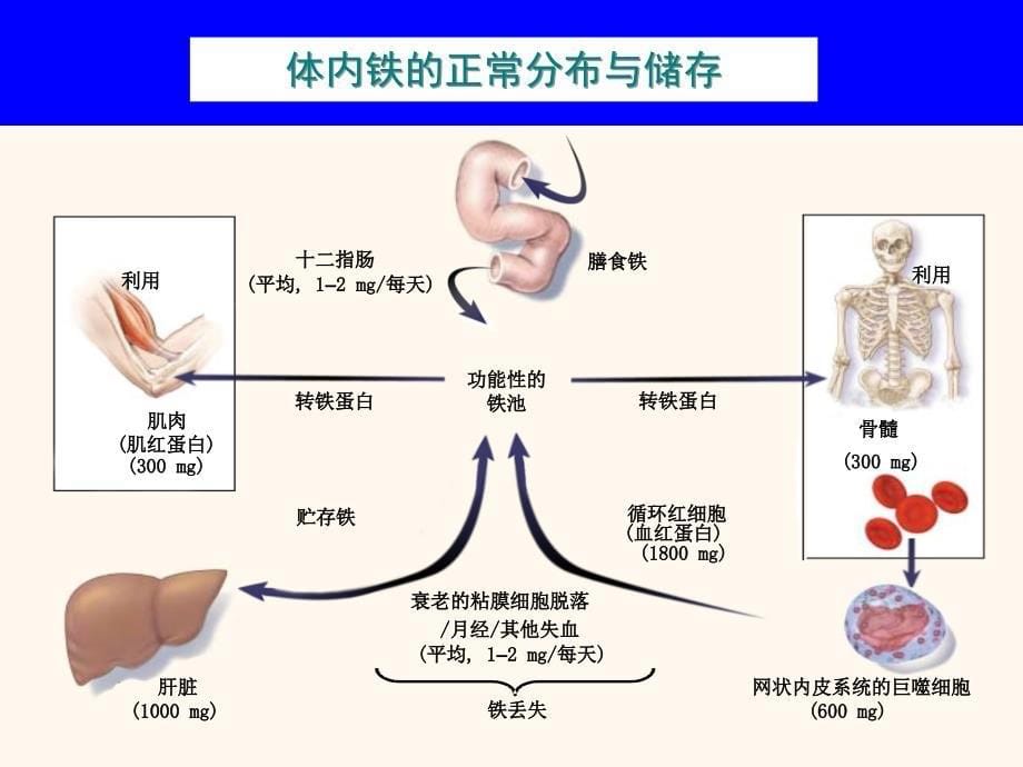 内科学课件：缺铁性贫血_第5页