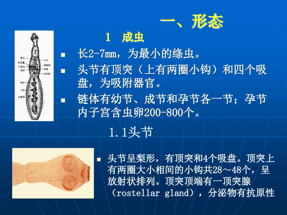 人体寄生虫学——包虫_第4页