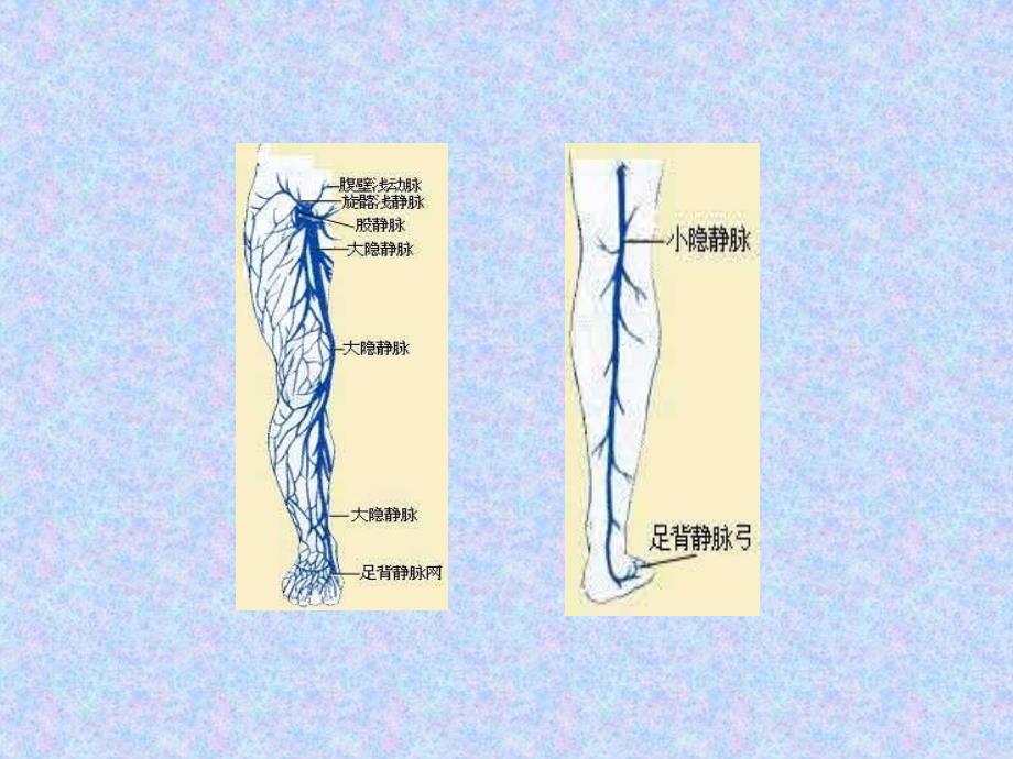 下肢深静脉血栓的介入治疗_第2页