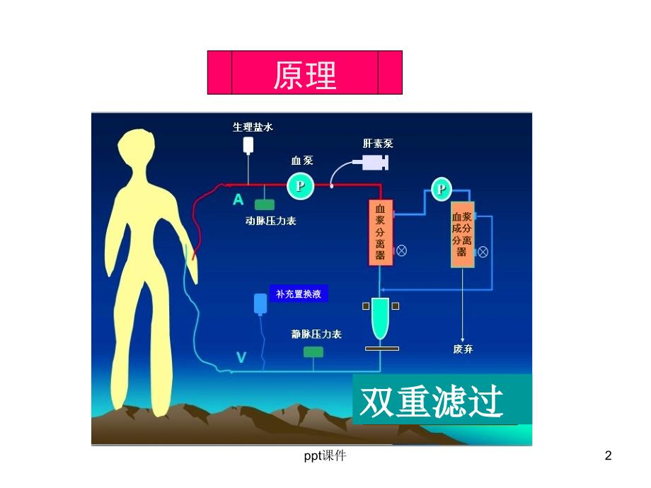 双重滤过血浆置换不良反应及处理ppt课件_第2页