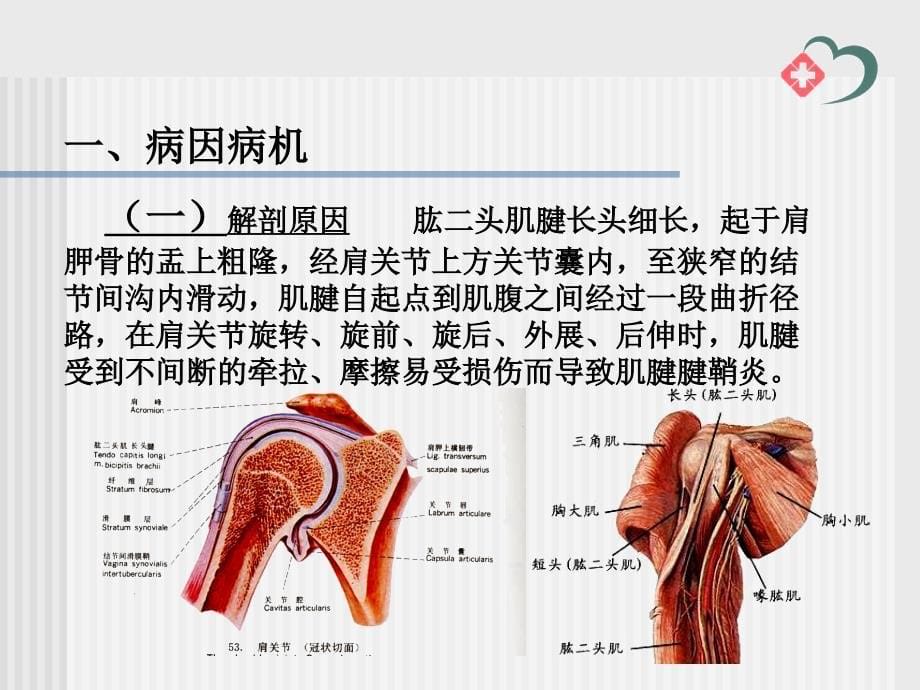 肱二头肌腱炎_第5页