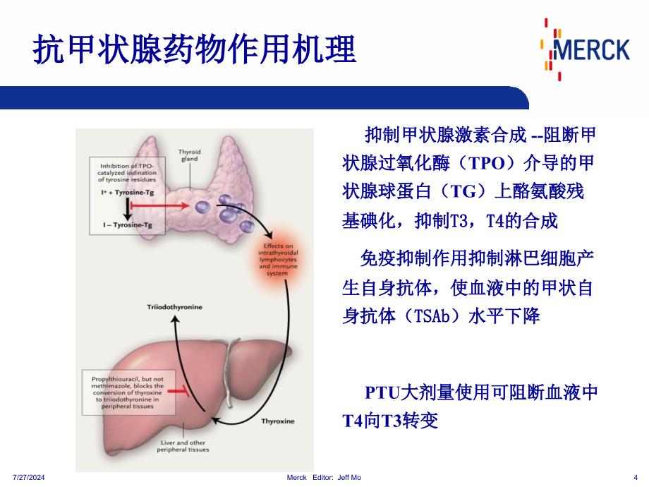 抗甲状腺药物选择_第4页