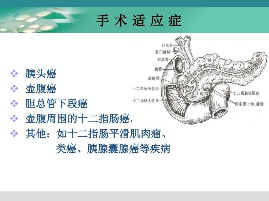 胰十二指肠切除术教学查房[]课件_第5页