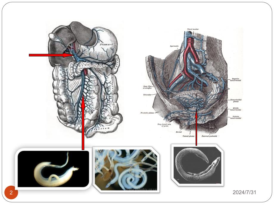 医学寄生虫学课件：6schistosome_第2页