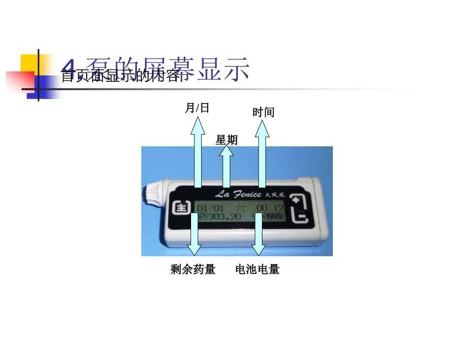 胰岛素泵操作课件_第5页