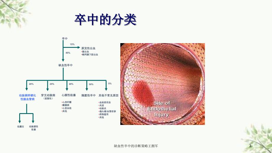 缺血性卒中的诊断策略王拥军课件_第3页