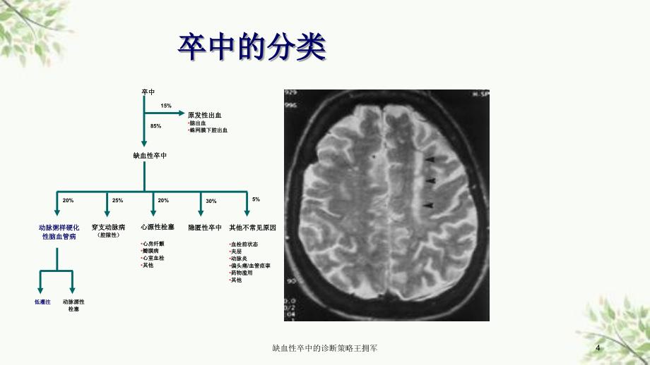 缺血性卒中的诊断策略王拥军课件_第4页