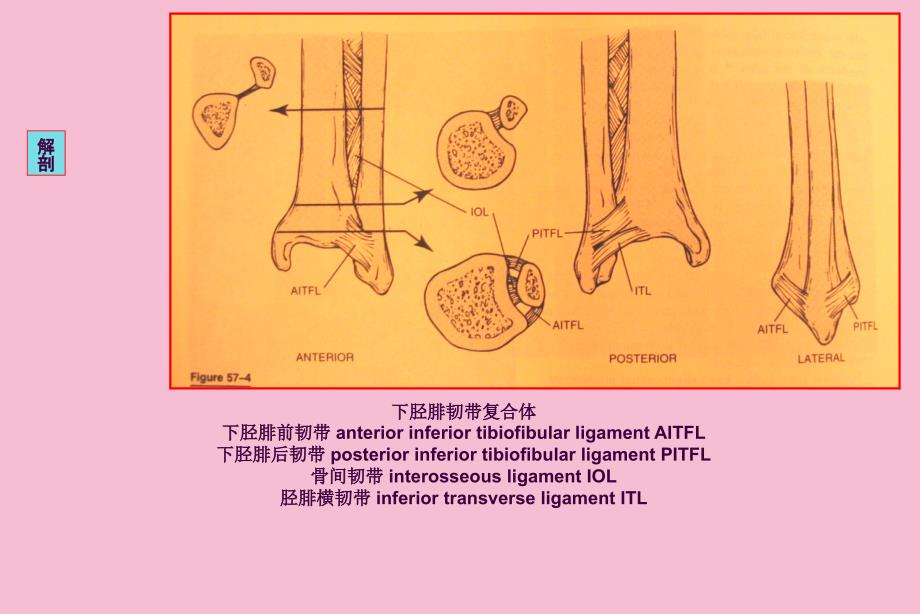 下胫腓联合损伤的诊治ppt课件_第3页