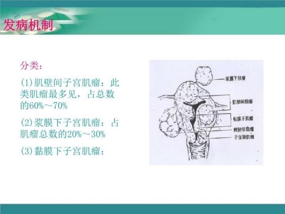 最新妊娠合并子宫肌瘤PPT课件_第5页