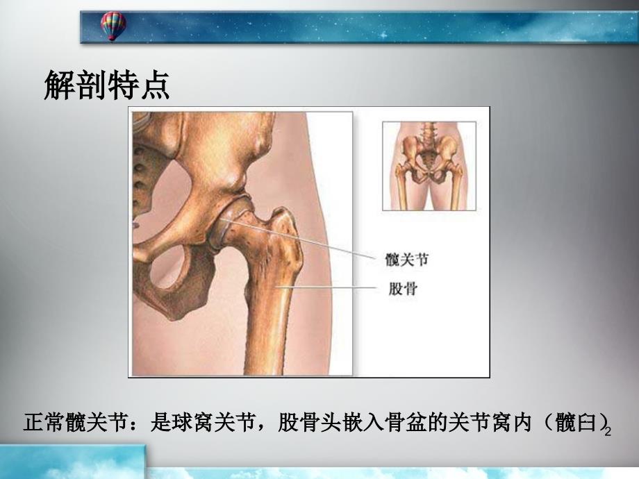 《髋关节置换病理》PPT课件_第2页