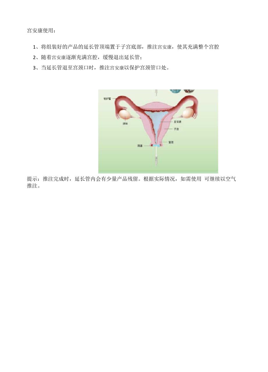 宫安康使用方法_第4页