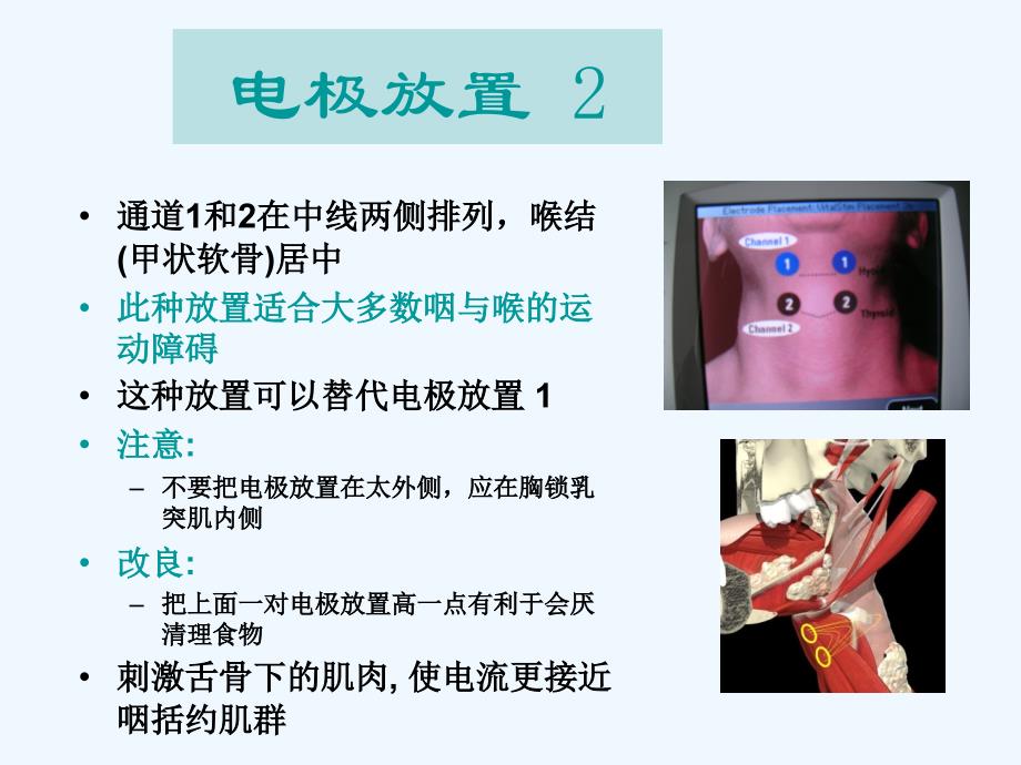 电极片的贴法_第2页