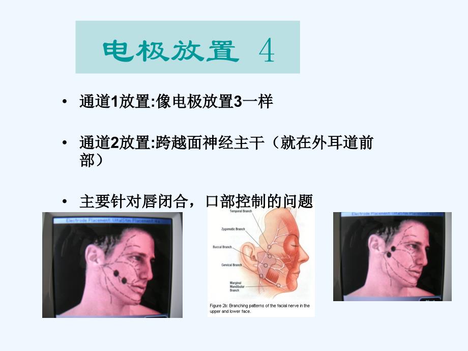 电极片的贴法_第4页