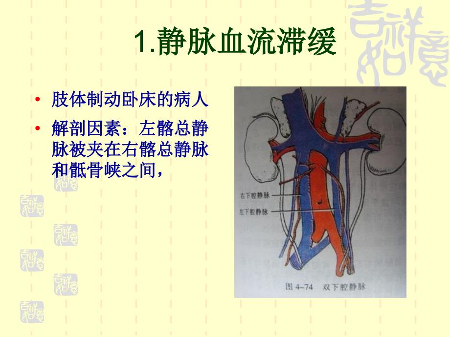 下肢深静脉血栓.ppt_第4页