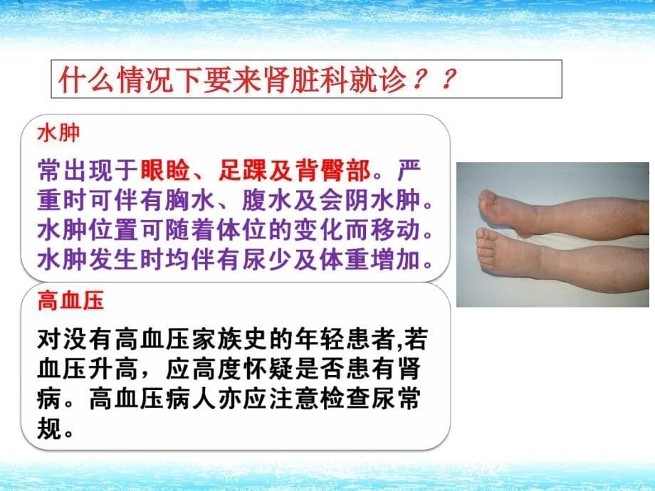 慢性肾脏病的营养治疗课件.ppt_第5页