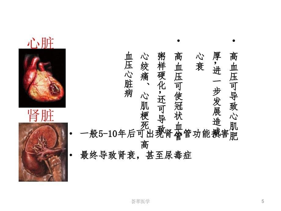 心脑血管疾病预防专业医疗_第5页