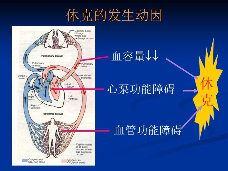 感染性休克病人的护理.ppt_第5页