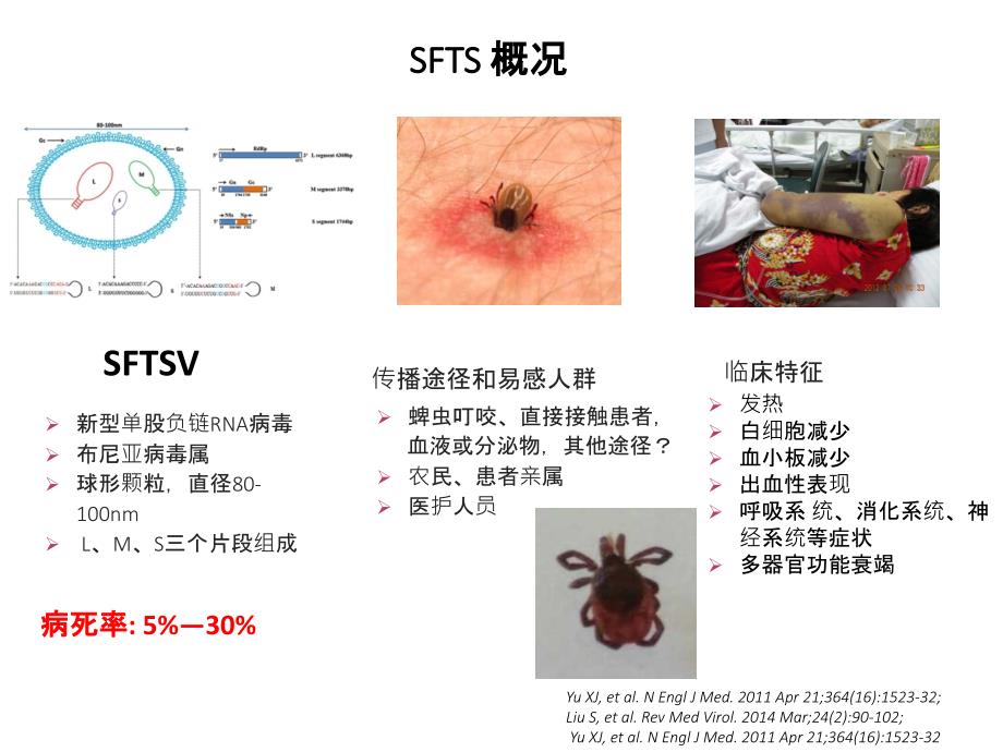 严重发热伴血小板减少综合征的诊疗及鉴别诊断_第3页