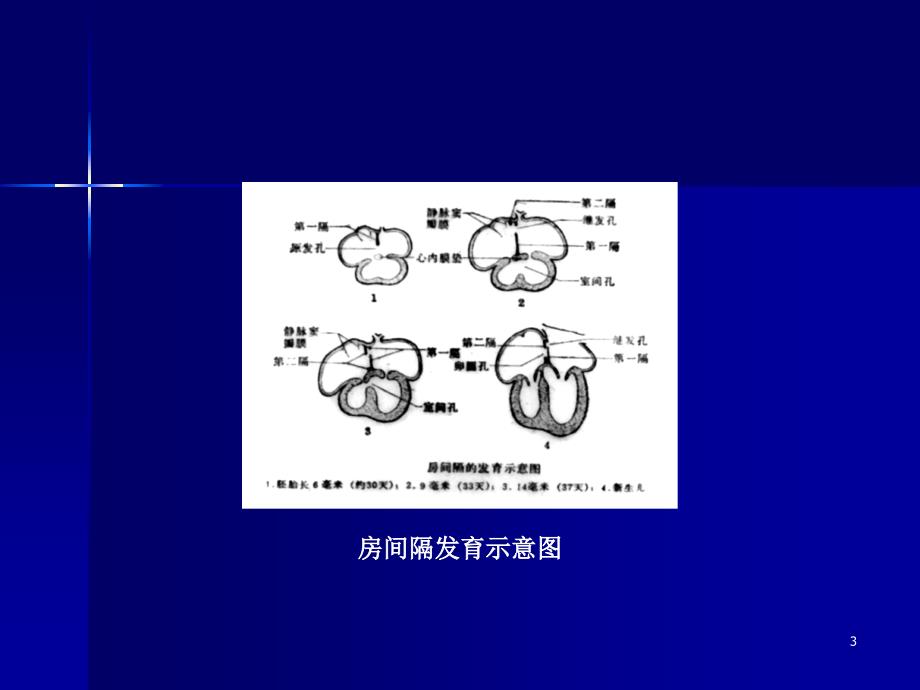 循环系统影像学诊断 PP课件_第3页