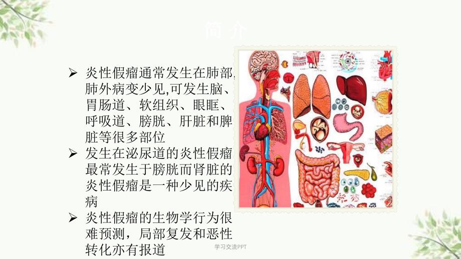 肾脏炎性假瘤影像诊断课件_第2页